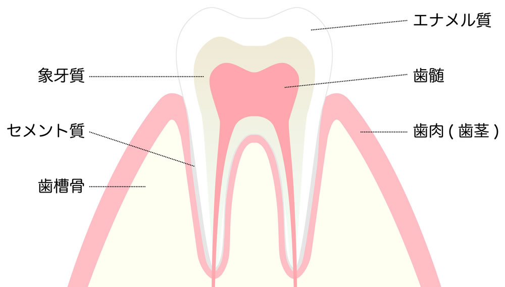 歯のエナメル質が失われる原因