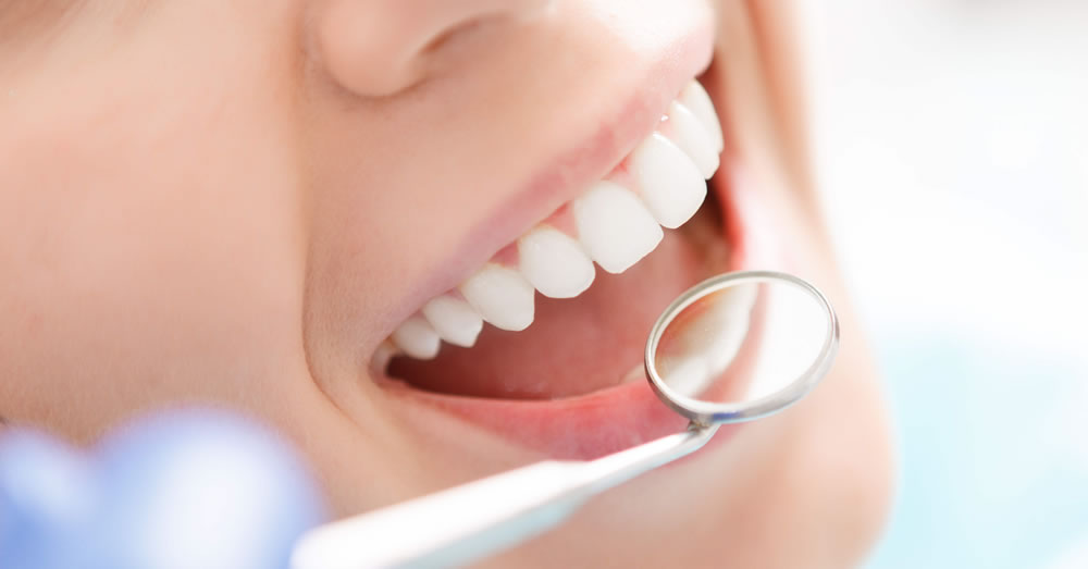 虫歯リスクが高い人の特徴